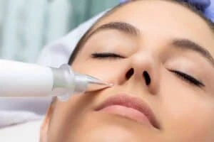 Best Actinic Keratoses Removal 3 Actinic keratoses Highworth solutions - book in today!