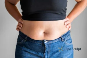 Bidding Farewell to Muffin Tops with Aqualyx Fat Injections 2 Do you wish you could reduce your muffin top Highworth With Aqualy fat dissolving injections you can!