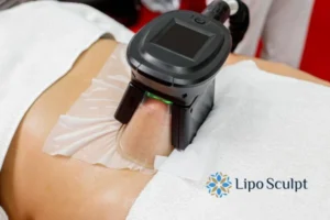 Does Fat Freezing At Home Work? 3 Fat freezing at home from Lipo Sculpt Highworth